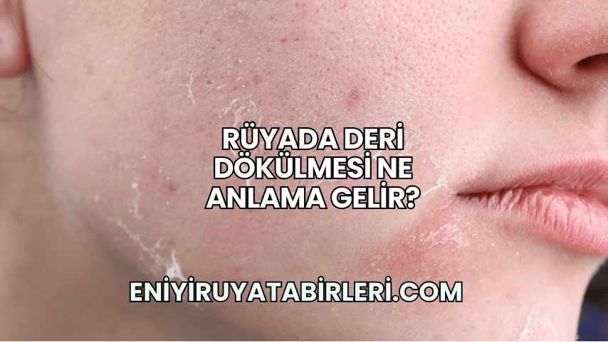 Rüyada Deri Dökülmesi Ne Anlama Gelir?