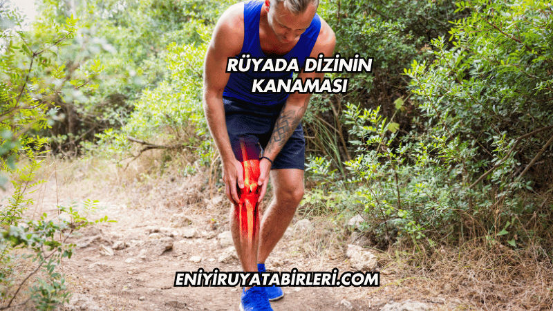 Rüyada Dizinin Kanaması